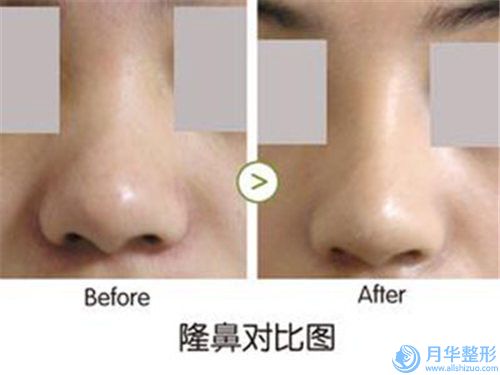 江蘇鎮(zhèn)江市第三人民醫(yī)院整形美容科價(jià)位表全新項(xiàng)目一覽-擅長項(xiàng)目做鼻尖矯正等