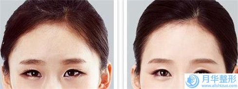 國內(nèi)切割雙眼皮修復好的醫(yī)生是誰：切割雙眼皮修復醫(yī)生50強名單送給你