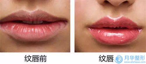國(guó)內(nèi)做臉部下巴抽脂比較出名的醫(yī)生：臉部下巴抽脂醫(yī)生前50位分享