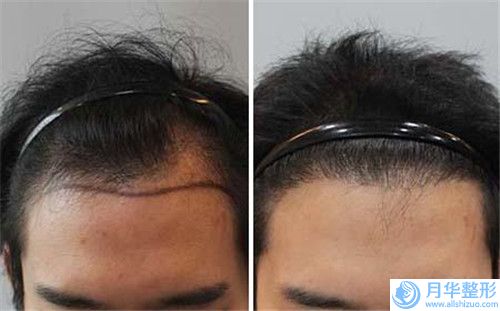 中國熱瑪吉全臉除皺醫(yī)院哪兒好：熱瑪吉全臉除皺醫(yī)院top50強哪家服務(wù)比較好