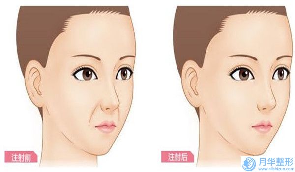 內(nèi)蒙古美萊整形美容醫(yī)院專(zhuān)業(yè)激光治療除太田痣醫(yī)生哪位醫(yī)生比較好