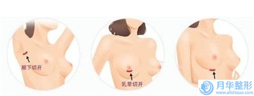 宿遷市正規(guī)額頭上縫針疤去除機構排名榜-宿遷人民醫(yī)院醫(yī)療整形科學歷高技術實力較好