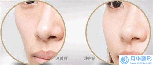 全國洗掉老式紋眉醫(yī)院哪兒好：洗掉老式紋眉醫(yī)院前50良心名單來啦