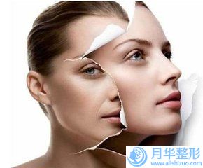 陳磊整形醫(yī)生srt100治療疤痕咋樣醫(yī)生個(gè)人資料擅長技術(shù)評(píng)價(jià)