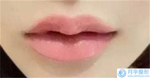 國內(nèi)自脂豐下巴良好的整容醫(yī)院是哪家：自脂豐下巴醫(yī)院前50集結(jié)