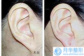 保定姮美整形美容醫(yī)院女孩子豐胸術(shù)可能要花多少錢
