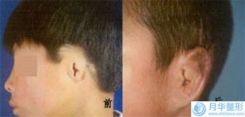 三亞市韓式假體隆胸手術(shù)醫(yī)生在榜名單強(qiáng)榜前十強(qiáng)橫評(píng)-王龍醫(yī)生實(shí)力上榜前三
