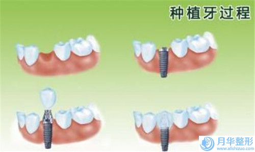 聊城市做吸脂大腿根部價格表(費用)_公布(做吸脂大腿根部均價為：10417元）