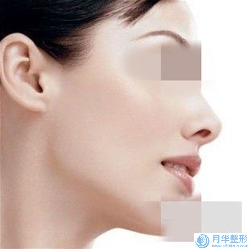 鄞州人民醫(yī)院整形美容科價位表價錢詳細信息-快速隆胸整容案例