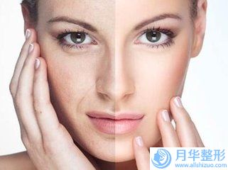 德陽市喬雅登打玻尿酸豐蘋果肌醫(yī)院上榜名單十強實力口碑一覽（德陽德美整形醫(yī)院來為您助力）