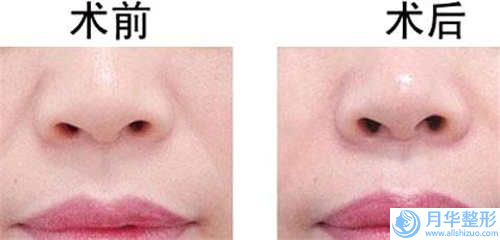 六盤水市下巴歪通過牙齒矯正牙科醫(yī)生上榜清單前十位正規(guī)介紹-黃國倫醫(yī)生領(lǐng)銜榜前三名
