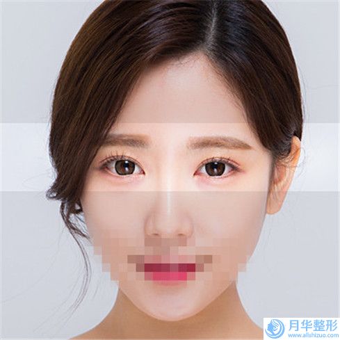 南通市拆除埋線雙眼皮子醫(yī)院排名前十強(qiáng)一個(gè)不落（南通市拆除埋線雙眼皮子整形醫(yī)院）