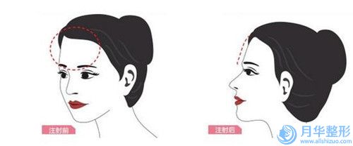 烏魯木齊市唇腭裂做手術(shù)修復(fù)價(jià)目表2025在線查詢-烏魯木齊市唇腭裂做手術(shù)修復(fù)醫(yī)院整形手術(shù)價(jià)格多少錢呢
