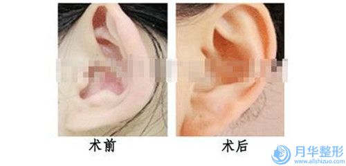 廊坊市整容醫(yī)院自身脂肪豐胸填充哪家可靠(廊坊人民醫(yī)院醫(yī)療整形美容科實(shí)力不俗)