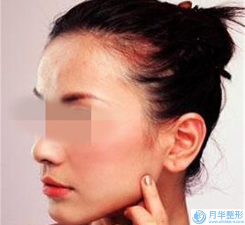 武漢市整容醫(yī)院自身脂肪注射豐胸哪幾家效果好(湖北省第三人民醫(yī)院美容整形科是不錯(cuò)的選擇)