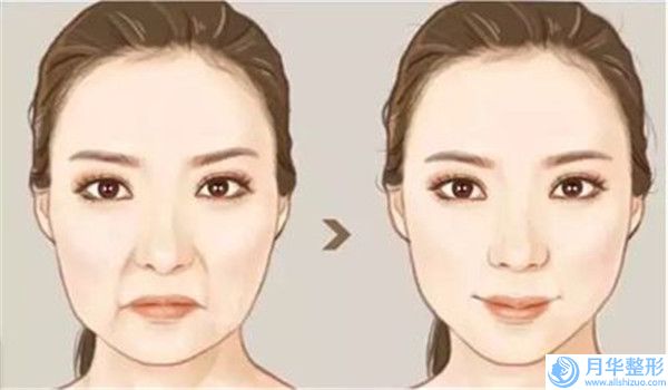 國內(nèi)哪個激光治療痘痘坑醫(yī)院好：激光治療痘痘坑醫(yī)院前50名上榜機(jī)構(gòu)盤點(diǎn)
