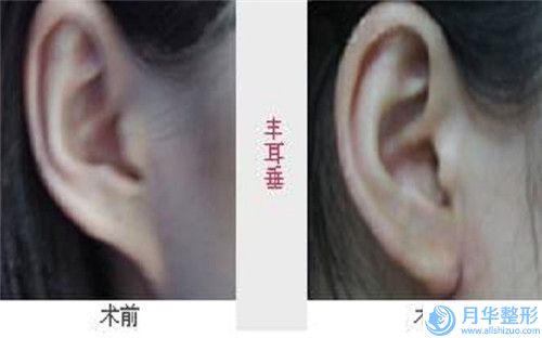 河南周口牙貝康口腔門診部?jī)r(jià)格(價(jià)目)2025熱門上線-乳牙固定術(shù)手術(shù)一般需要多少費(fèi)用