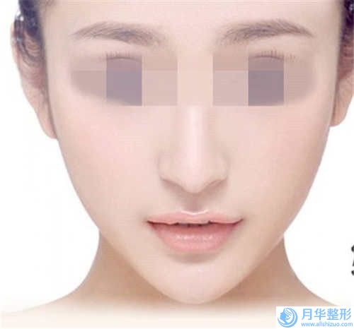 鄭日進(jìn)整形醫(yī)生做嗨體打下巴什么風(fēng)格好嗎醫(yī)生個(gè)人資料嗨體打下巴案例