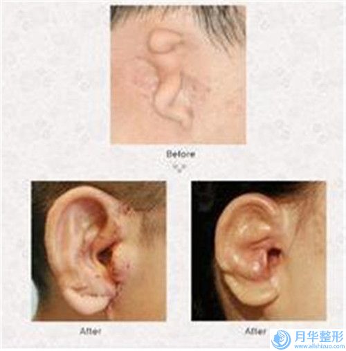 長沙市國內(nèi)隆胸醫(yī)院哪家規(guī)模比較大-國內(nèi)隆胸價格為什么不一致