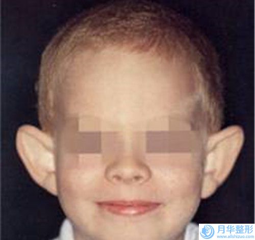 大理白族自治州曼托妙桃豐胸價格(費用)清單分析-大理白族自治州曼托妙桃豐胸手術(shù)費用一般是多少呢