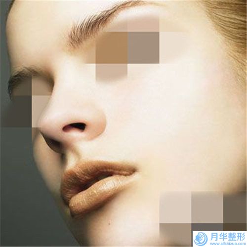 煙臺市鼻頭縮窄手術(shù)大概需多少錢-價格在27144元起