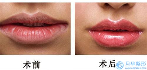 嘉定區(qū)牙齒矯正下巴后縮醫(yī)院好的有那些-上海摩恩齒科是技術(shù)派