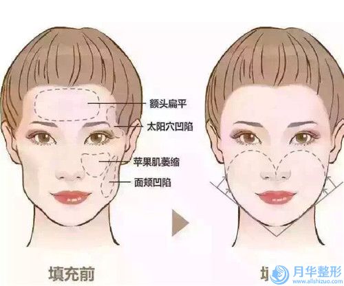 呼和浩特市唇裂疤痕怎么修復(fù)醫(yī)院-內(nèi)蒙古醫(yī)學(xué)院第三附屬醫(yī)院美容整形外科你比較看好哪一家