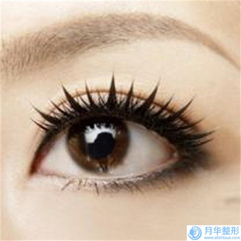 范希玲醫(yī)生注射嗨體去淚溝案例-價(jià)格(價(jià)目)全新解密一覽
