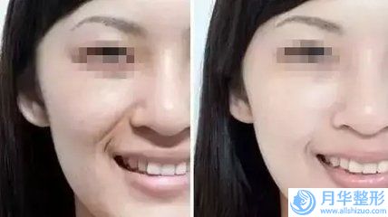 石能醫(yī)生中不中｜治療疤痕體質(zhì)｜附烏魯木齊雍禾醫(yī)療美容診所價目表