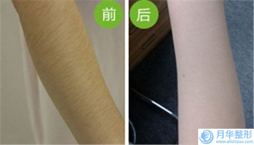 鹽城市面部除皺美容醫(yī)生上榜名單前10位醫(yī)生大PK（林鵬飛醫(yī)生好還便宜）