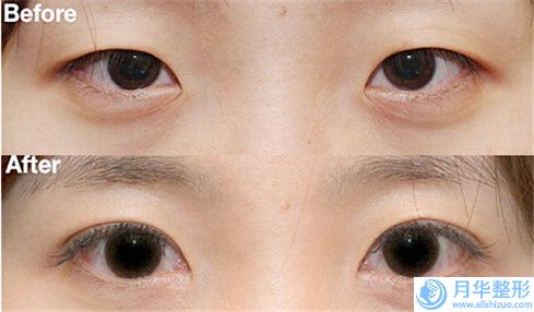云南中醫(yī)學(xué)院第二附屬醫(yī)院可否進(jìn)小兒眼窩凹陷手術(shù)